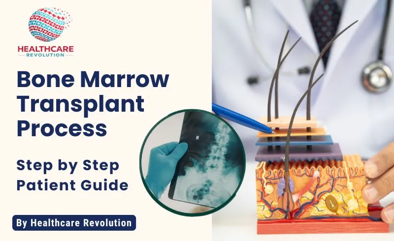 Bone Marrow Transplant Process Step by Step