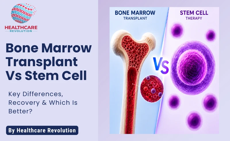 Stem Cell vs Bone Marrow Transplant: Key Differences, Benefits